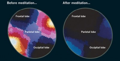 brain and meditation 1.jpg
